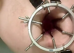 Enema, anal shower. Close-up view through anal mirror. Anal with water. Filling anal with water