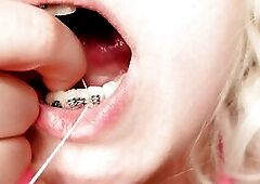 My 2nd day in braces: cleaning by dental floss