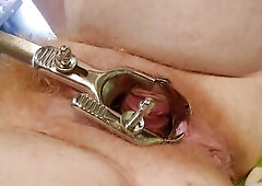 Need larger speculum